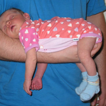 Baby-Blähungen - Fliegergriff